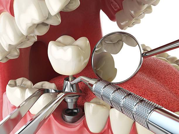 Best Emergency Root Canal Therapy in Maize, KS